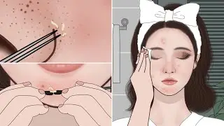 Oddly Satisfying ASMR Animation: Pimple Popping + Blackhead Removal ✨ Night Skincare Routine