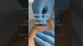How Dry Needling Helps Hand Rehab 💙