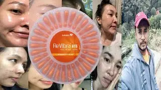 revibra a15 pure retinol cream | honest review