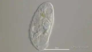 トリシグモストマ（Trithigmostoma sp.）