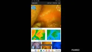Brief Description of DrOroscope non invasive oral cancer screening device