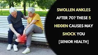 Swollen Ankles After 70? These 5 Hidden Causes May Shock You