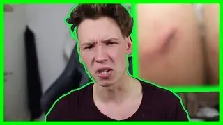 Ben Mitkus blir attackerad?? YTber skadar rumpan, Joakim Lundell räddar getter!