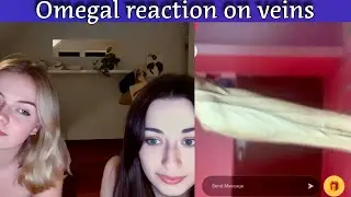 💀You have never seen such reaction on omegal before👿