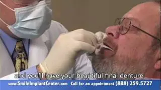 Excellent treatment for replacing them is a UPPER denture secured with implants.