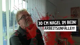 Arbeitsunfälle - Wenn dann leider richtig heftig!