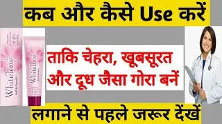 White tone cream benefits & side effects |white tone soft & smooth |whitetone ke fayde aur nukshan