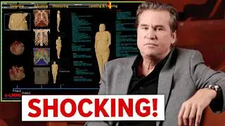 DISTURBING Details Found in Val Kilmer's Autopsy Report!