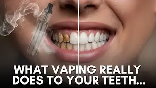 Vaping & Your Teeth 🚭 The Hidden Damage You Need to Know!