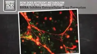 How Does Nutrient Metabolism Influence the Immune System- Dr. Barry Bradford