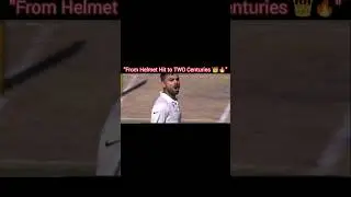 Virat Kohli vs Mitchell Johnson: Helmet Hit But Twin Centuries! 🔥 #cricket #shorts