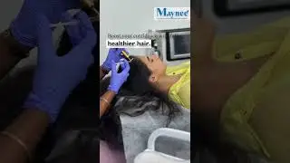 GFC Treatment | Hair loss Treatment | Maynee Cosmetology Clinic