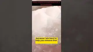 HOW to Remove Plaque Form TEETH #shorts #selfcare