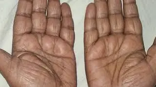 SHANKHA MUDRA for Congestion, Vocal cord , Stammering and Thyroid issue