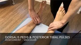 Vascular Assessment - Foot Pulses