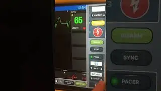 Transcutaneous Pacing