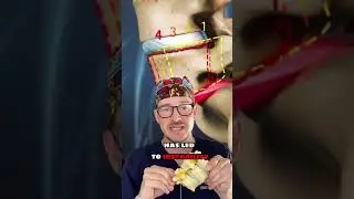 Перелом Парса &mdash; это&hellip;