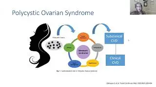 Cardiovascular Prevention in Women over a Lifespan