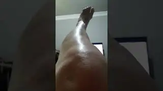 REPOUSO  FOR&Ccedil;ADO PELA  DOR ENTENSA  SEM LIMITE  SE TENTA   LEVANTAR  CAIO .  (2)
