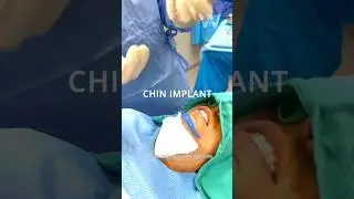 Behind the scenes of the OR: Chin Implant (Chin Augmentation) for profile definition