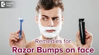 Razor bumps on face after shaving. Causes & Treatment - Dr. Rajdeep Mysore