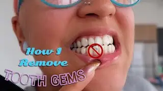 HOW I REMOVE MY TOOTH GEMS AT HOME