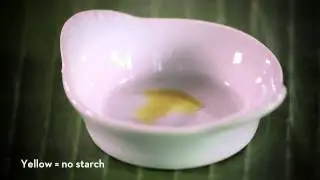 Carbohydrates and starch : color test with iodine solution