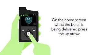 MiniMed™ 780G - Bolus with the SmartGuard™ feature