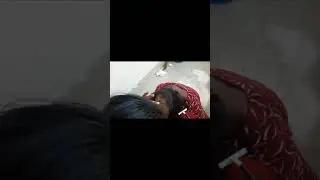 উকুন মারার সহজ উপায়🐵🐵🐵