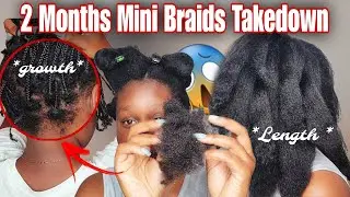 2 MONTHS MINI BRAIDS TAKEDOWN | The Result Will Blow Your Mind ‼️😱😱 *Must Watch* | Christal B. 
