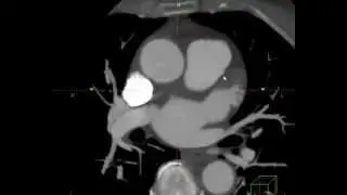 CCTA Case 31