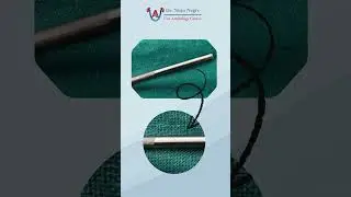 PCNL Surgery Surprise | Molten Metal Pieces Found Inside Kidney During Operation | Dr Nitin Negi