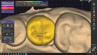 Emax overlay on RL5