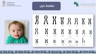 الكروموسومات