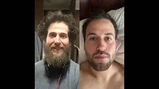 Rory's Story - Heroin Addiction to Ayahuasca to Getting Clean - Importance of Integration