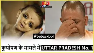 कुपोषण के मामले में UTTAR PRADESH No. 1, कौन है जिम्मेदार ?