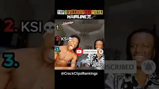 Top 3 WORST YouTuber Hairlines&hellip; Who Did This?! 😭 #shorts