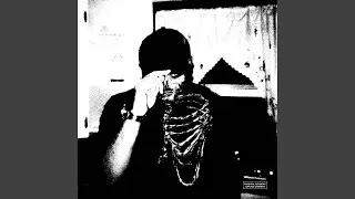 X-RAY