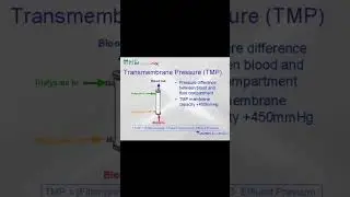 Causes of high TMP🖋️TMP tends to rise gradually over the course of the dialysis sessions #trending
