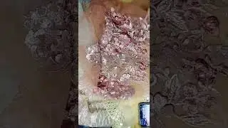 Live highlight