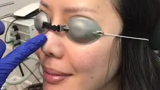 Laser Eyebrow Tattoo Removal By Dr Tariq Ali Khan, MD