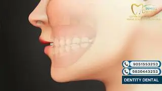 What is Skeletal Classification? | Dentity Dental Explains Orthodontics Clearly