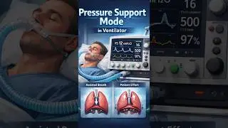 pressure support mode in ventilator #medicine #ventilator #icu