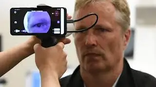 First open source smartphone ophthalmoscope: oDocs sets world record
