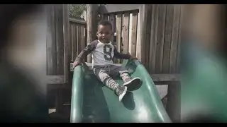 The Impact of Congenital Heart Defects