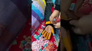 Smart Hand Rehab Tool 😲🧤!!#facts #medical #technology  #patientcare  #trending #youtubeshorts