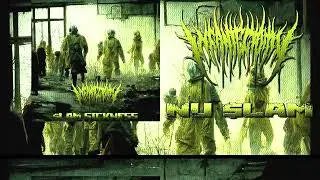 INFANTECTOMY - NU $LAM (OFFICIAL AUDIO)