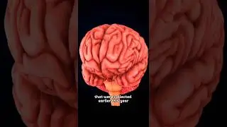Plastic in our Brains #microplastics #brain #plastic