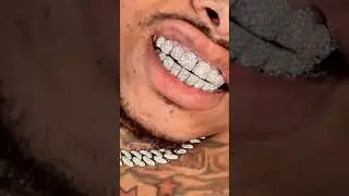VVS LAB DIAMOND PERMANENT GRILLZ
