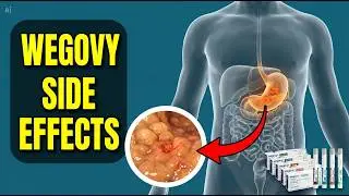 Wegovy Side Effects &ndash; What to Expect & How to Manage Them! ⚠️